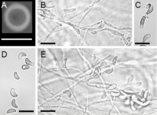 Geomyces destructans, cultural and microscopic characteristics   A. Colony on CMA after 16 days at 7C. B. Conidiophores with
conidia in short chains. C. Conidia with separating cell. D. Curved conidia. E. Conidiophores
showing acute branching. Scale bars: A = 1 cm, B-E = 10 µm.