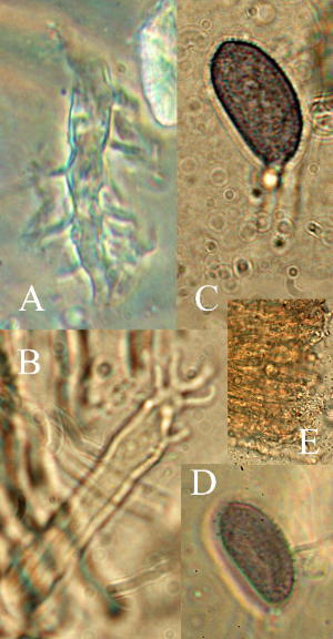 Aleurodiscus oakesii microscopic characteristics