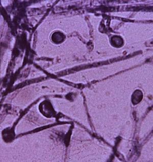 Blastomyces mycelial form, with conidia