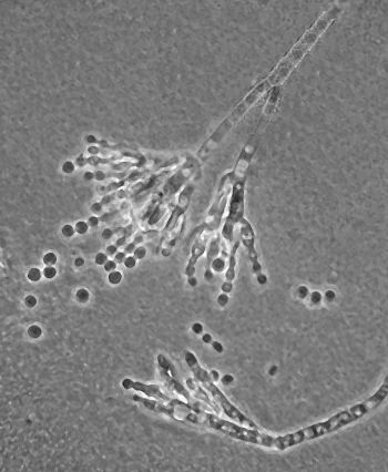 penicillium notatum condition