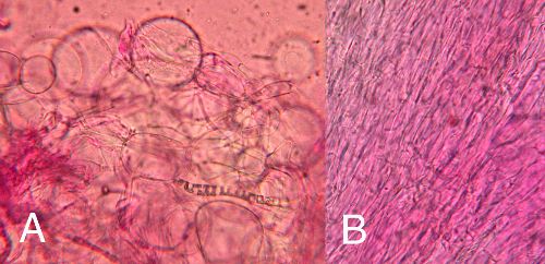 sphaerocysts of Russula on the left, hyphae of a regular mushroom on the right