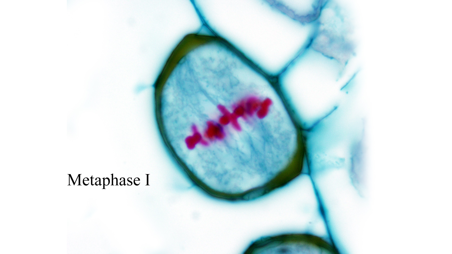 Micrograph Metaphase Department of Botany