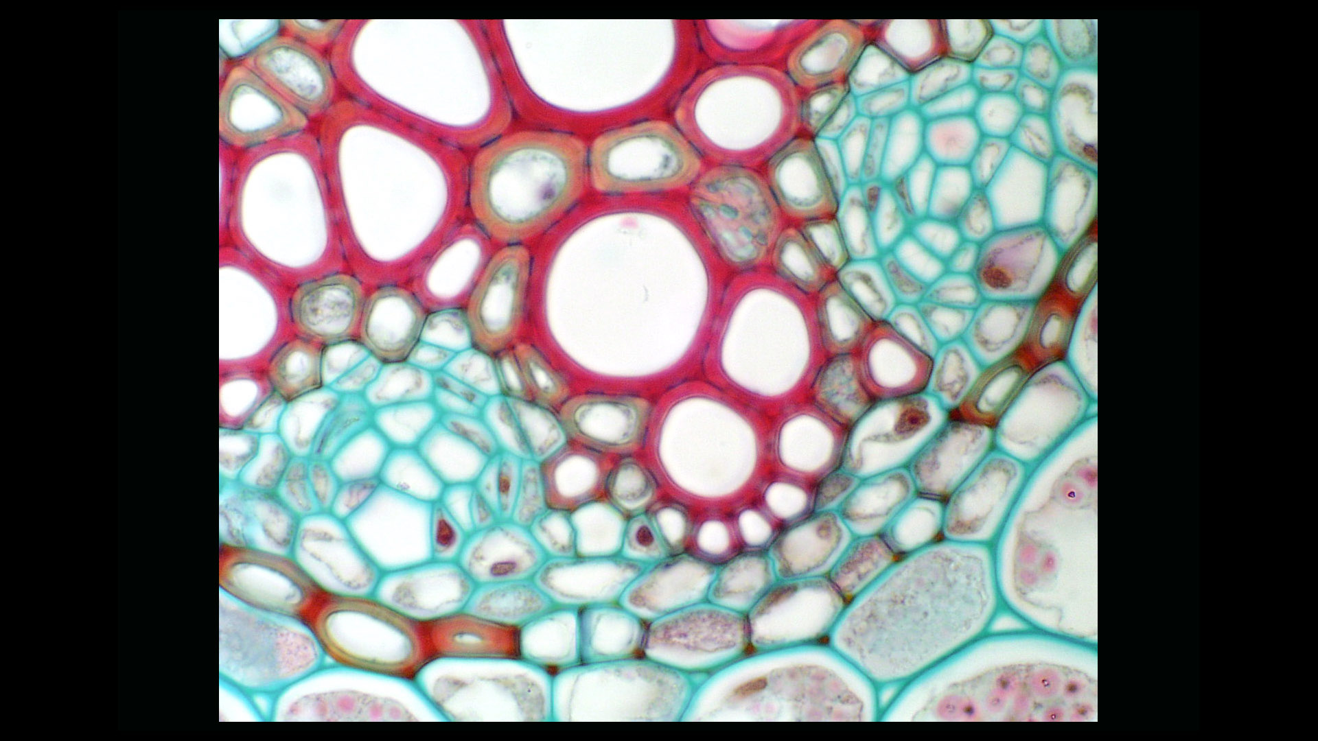 Protoxylem Root Department of Botany
