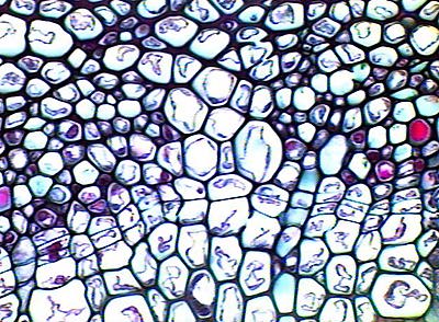 Interascicular cambium