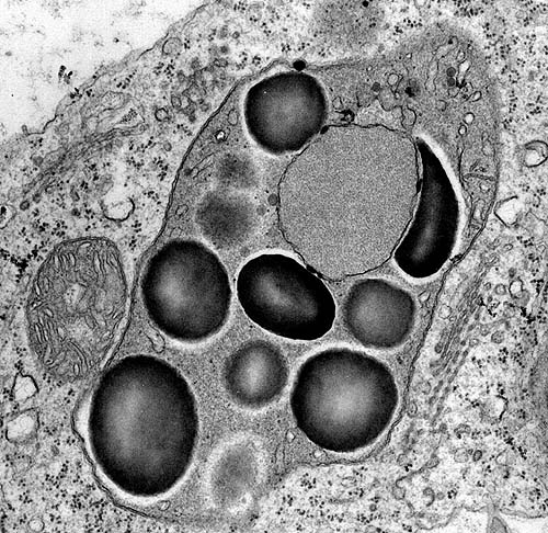 dictyosomes