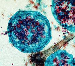 Eurotium and Aspergillus