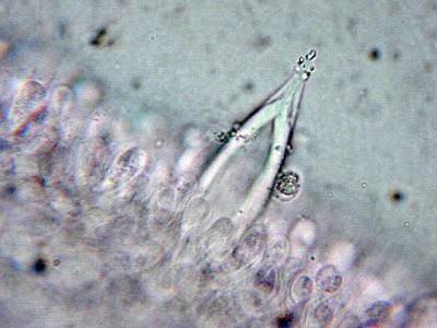 Pleurogenoides sp. in the oral cavity of Atheris hispida LAURENT, 1955.