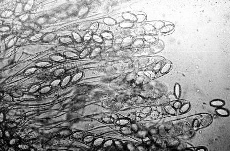 Intact asci with ascospores from Morchella